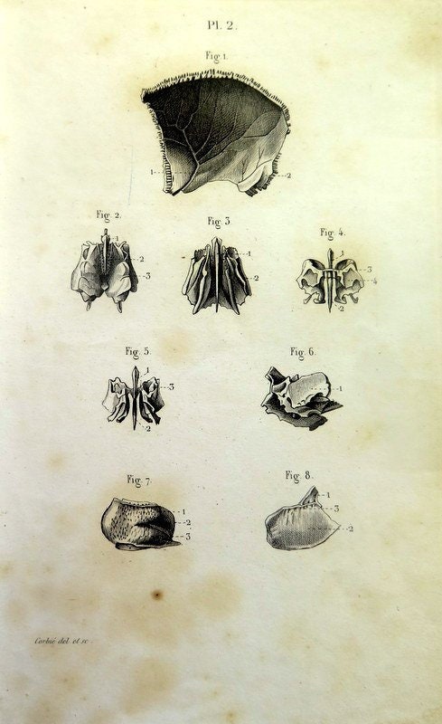 Antique Print Of Anatomy 1846 , Cranial Section Engraving , Vintage ...